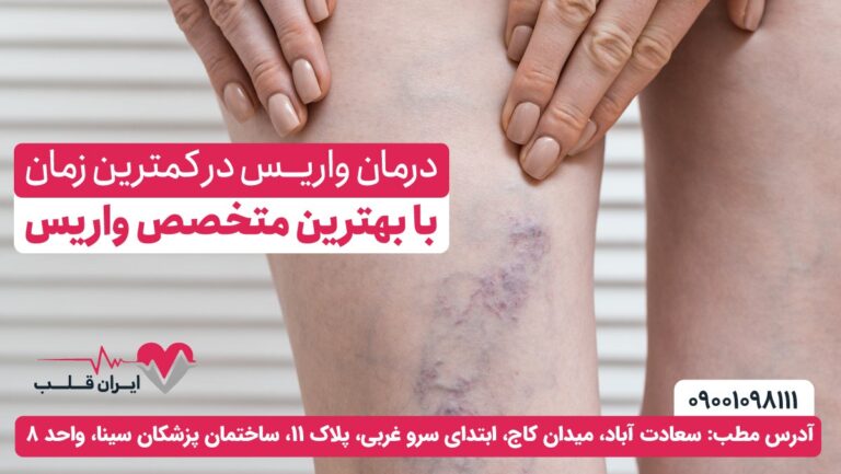 درمان واریس در کمترین زمان  با بهترین متخصص واریس