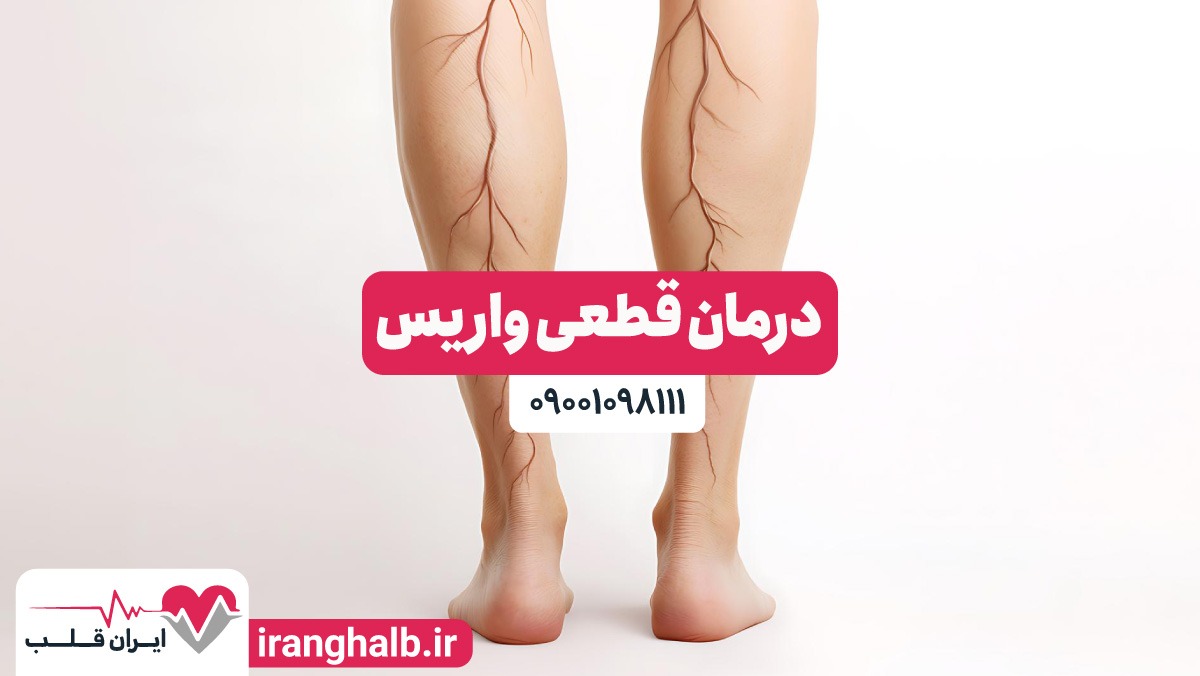 خداحافظی با درد و سنگینی پاها | درمان قطعی واریس