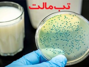 اوج‌گیری تب مالت در بهار / توصیه‌های بهداشتی برای پیشگیری از بروسلوز