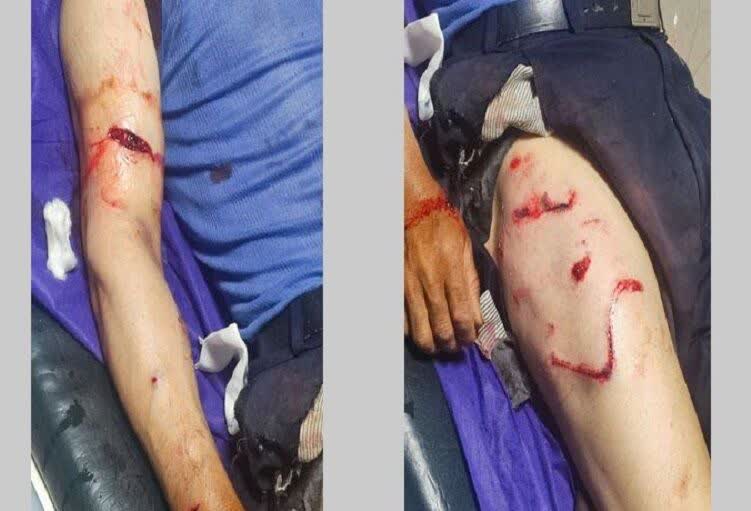 حمله خرس به یک روستایی در مراغه